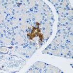 TSC1 Antibody in Immunohistochemistry (Paraffin) (IHC (P))