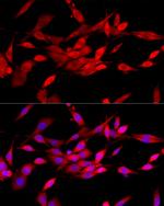 c-Cbl Antibody in Immunocytochemistry (ICC/IF)