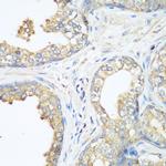 c-Cbl Antibody in Immunohistochemistry (Paraffin) (IHC (P))