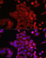 STAT6 Antibody in Immunocytochemistry (ICC/IF)