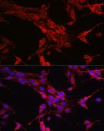 STAT6 Antibody in Immunocytochemistry (ICC/IF)