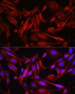 STAT6 Antibody in Immunocytochemistry (ICC/IF)