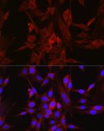 STAT6 Antibody in Immunocytochemistry (ICC/IF)