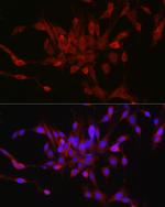 STAT6 Antibody in Immunocytochemistry (ICC/IF)