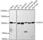 STAT6 Antibody in Western Blot (WB)