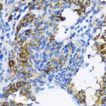 PTCH Antibody in Immunohistochemistry (Paraffin) (IHC (P))