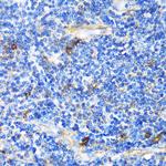 PTCH Antibody in Immunohistochemistry (Paraffin) (IHC (P))