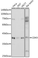 CDK9 Antibody in Western Blot (WB)