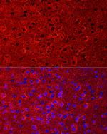 GLT-1 Antibody in Immunocytochemistry (ICC/IF)