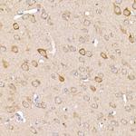 TRAF2 Antibody in Immunohistochemistry (Paraffin) (IHC (P))