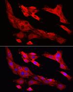 Caspase 1 Antibody in Immunocytochemistry (ICC/IF)