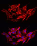 Caspase 1 Antibody in Immunocytochemistry (ICC/IF)