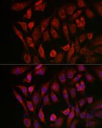 Cathepsin B Antibody in Immunocytochemistry (ICC/IF)