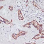 RAP1A Antibody in Immunohistochemistry (Paraffin) (IHC (P))