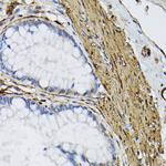 TGM2 Antibody in Immunohistochemistry (Paraffin) (IHC (P))