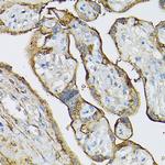 TGM2 Antibody in Immunohistochemistry (Paraffin) (IHC (P))