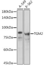 TGM2 Antibody in Western Blot (WB)