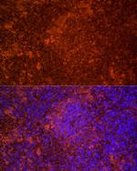 TLR7 Antibody in Immunocytochemistry (ICC/IF)