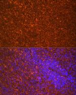 TLR7 Antibody in Immunocytochemistry (ICC/IF)