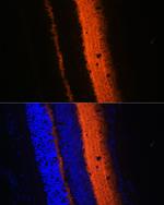 Synaptotagmin 1 Antibody in Immunohistochemistry (Paraffin) (IHC (P))