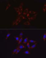 HK2 Antibody in Immunocytochemistry (ICC/IF)