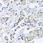 HK2 Antibody in Immunohistochemistry (Paraffin) (IHC (P))