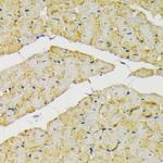 HK2 Antibody in Immunohistochemistry (Paraffin) (IHC (P))