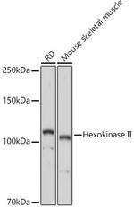 HK2 Antibody in Western Blot (WB)