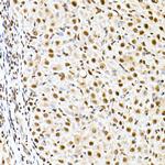 ID2 Antibody in Immunohistochemistry (Paraffin) (IHC (P))