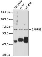 GABRB3 Antibody in Western Blot (WB)