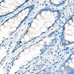 YAP1 Antibody in Immunohistochemistry (Paraffin) (IHC (P))