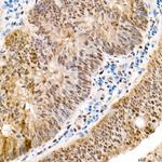 YAP1 Antibody in Immunohistochemistry (Paraffin) (IHC (P))