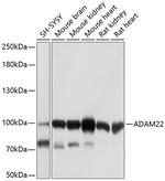 ADAM22 Antibody in Western Blot (WB)