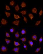 SUCLA2 Antibody in Immunocytochemistry (ICC/IF)