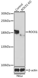 ROCK1 Antibody