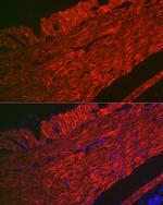 Alpha-Smooth Muscle Actin Antibody in Immunocytochemistry (ICC/IF)