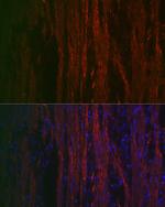 Alpha-Smooth Muscle Actin Antibody in Immunocytochemistry (ICC/IF)