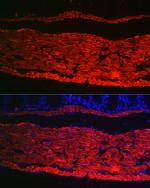 Alpha-Smooth Muscle Actin Antibody in Immunocytochemistry (ICC/IF)