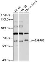 GABRR2 Antibody in Western Blot (WB)