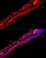 KRT9 Antibody in Immunocytochemistry (ICC/IF)