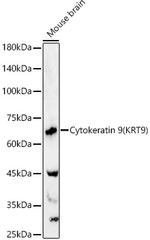 KRT9 Antibody in Western Blot (WB)