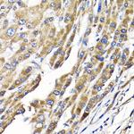 IKAP Antibody in Immunohistochemistry (Paraffin) (IHC (P))