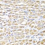 IKAP Antibody in Immunohistochemistry (Paraffin) (IHC (P))