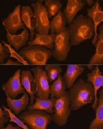 HLA-C Antibody in Immunocytochemistry (ICC/IF)