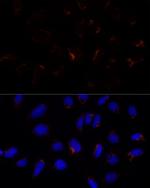 ETHE1 Antibody in Immunocytochemistry (ICC/IF)