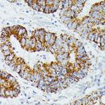 ETHE1 Antibody in Immunohistochemistry (Paraffin) (IHC (P))