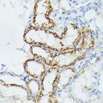 ETHE1 Antibody in Immunohistochemistry (Paraffin) (IHC (P))