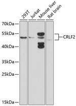 TSLP Receptor Antibody in Western Blot (WB)