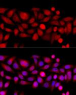 KIF4A Antibody in Immunocytochemistry (ICC/IF)