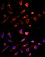 GPR30 Antibody in Immunocytochemistry (ICC/IF)